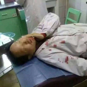 九江市中医院一医生遭六旬老人持刀捅伤 伤人者疑为精神病患 ...